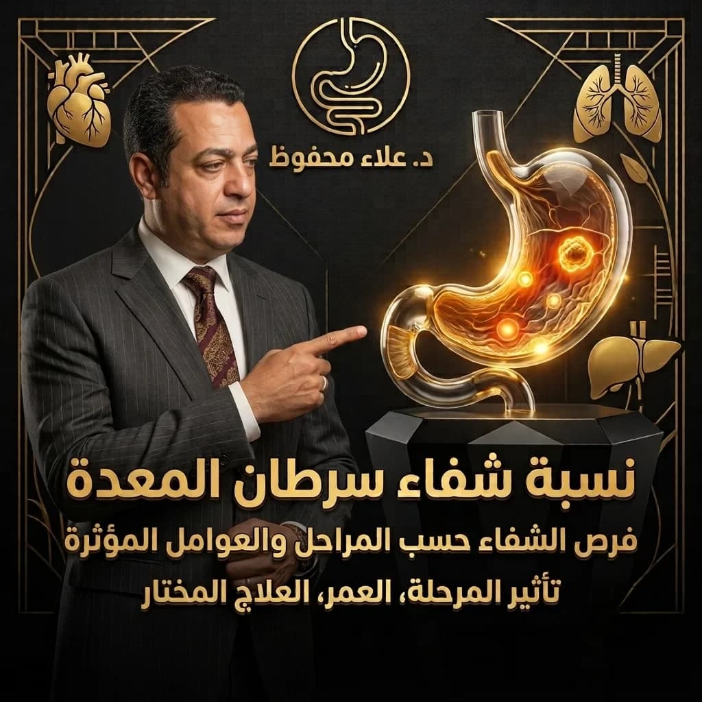 نسبة شفاء سرطان المعدة