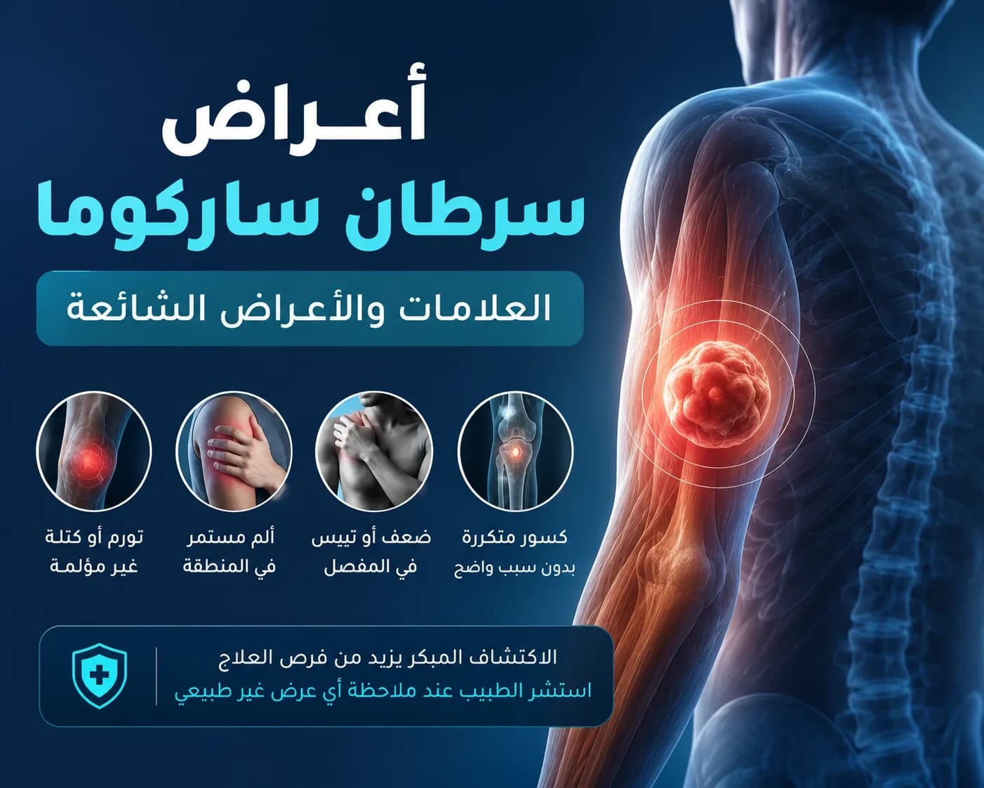 Sarcoma Cancer Symptoms | Signs, Causes & Diagnosis